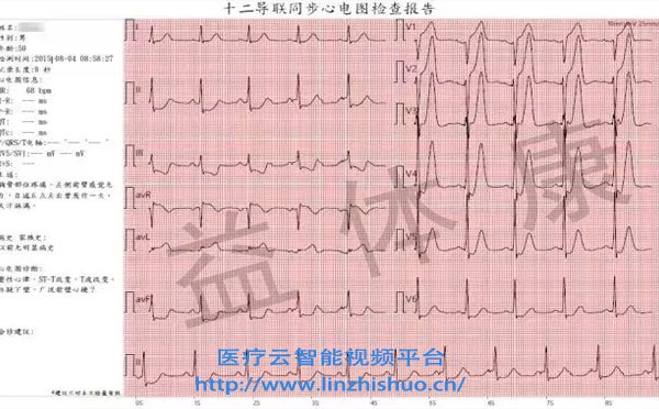 遠程心電會診系統(tǒng)